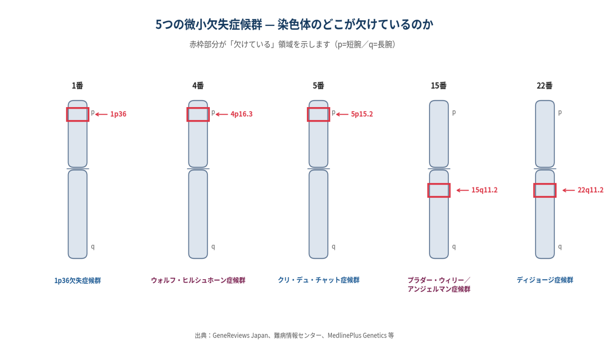 【図1】5 つの微小欠失症候群と、それぞれの染色体上の欠失位置。赤枠の部分が「欠けている」領域を示します。